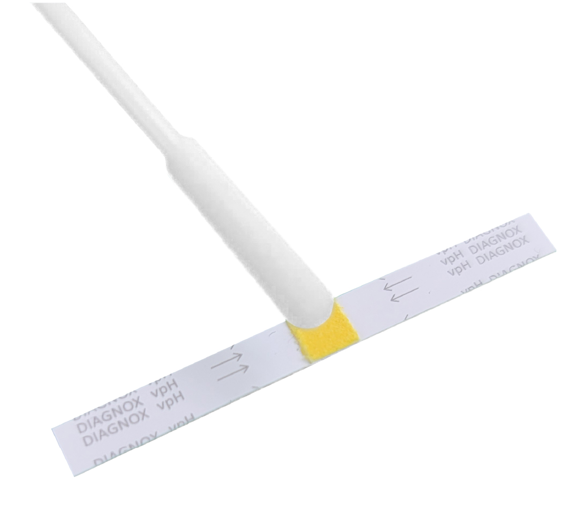 How To Carry Out an Athome Yeast Infection Test